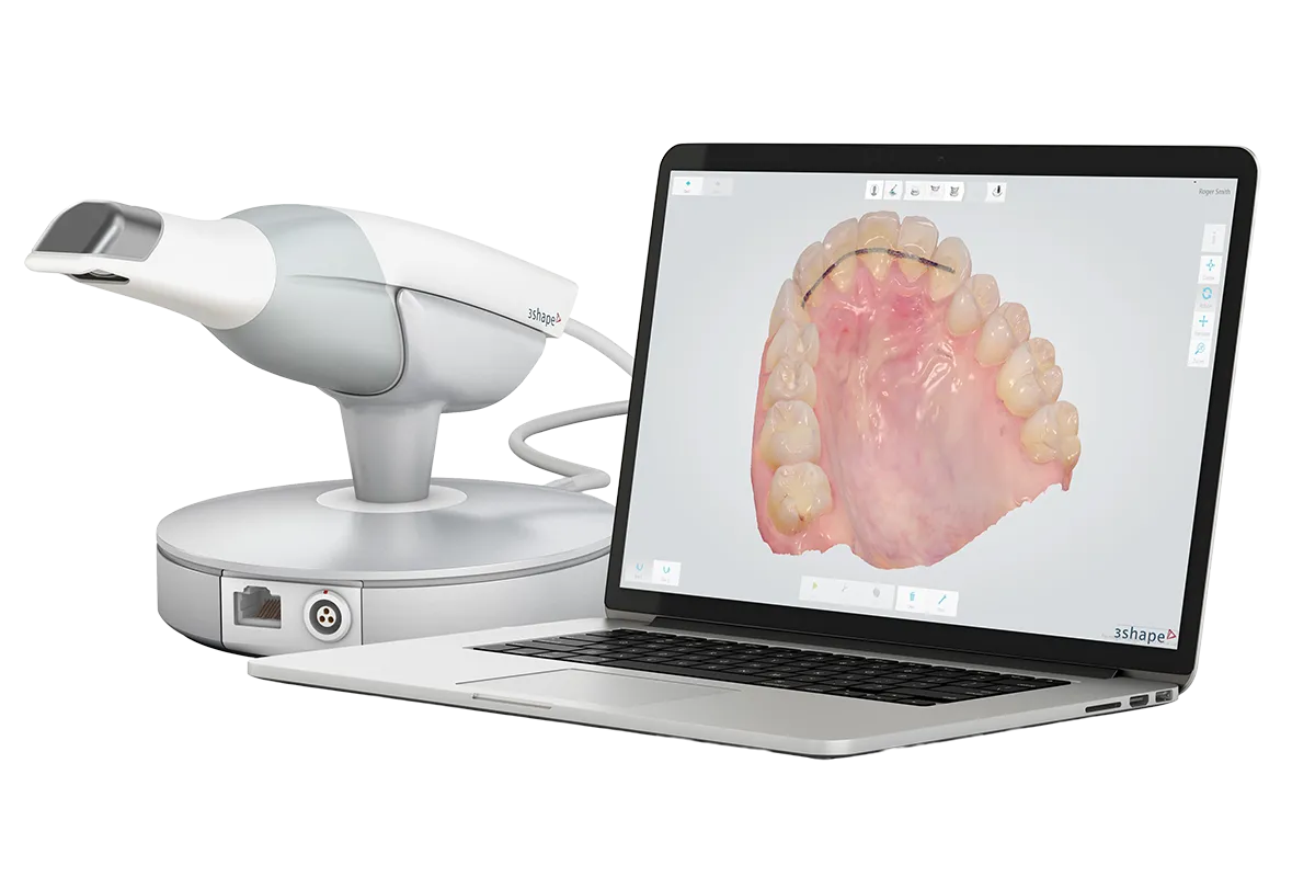 Abbildung eines Intraoralscanner, mit dem Abruckmasse verhindert werden kann