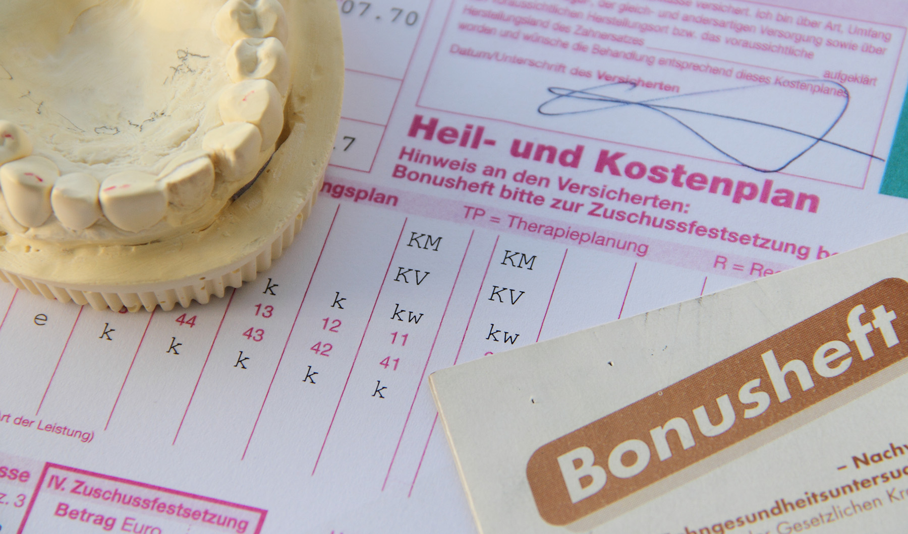 Gipsmodell eines Gebisses neben Heil- und Kostenplan in der Zahnarztpraxis Podbi344, Hannover.